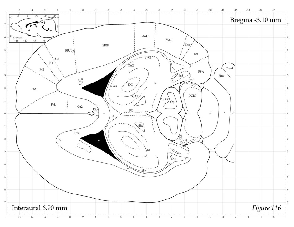 A Stereotaxic Atlas Of The Rat Brain Pdf