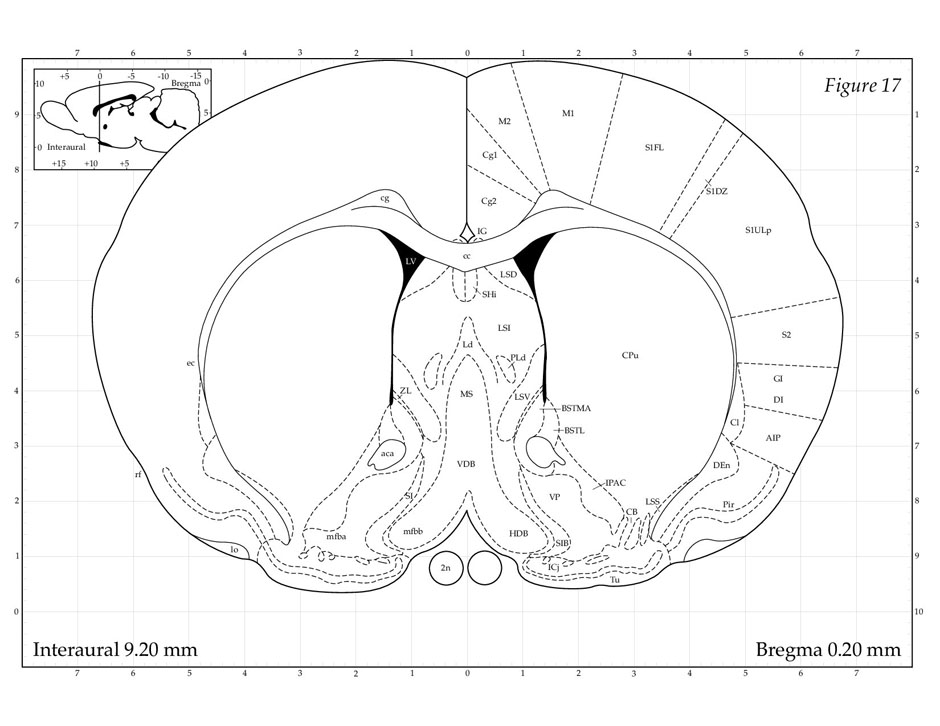 brain hippocampus coronal